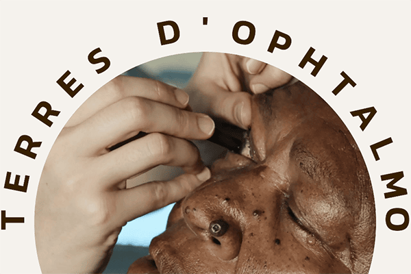 lutter contre la cécité terres d ophtalmo association d ophtalmologistes ong